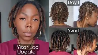 1 Year Loc Update|Pics & videos| Before & After|Thin & Fine| 4c Hair| Alopecia