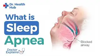 What Is Sleep Apnea? Signs, Causes, Treatment & Prevention Explained