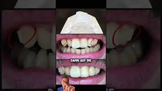 Krumme Dinger drehen 🤔 | Zahnarzt Dr. Maximilian Fuhrmann