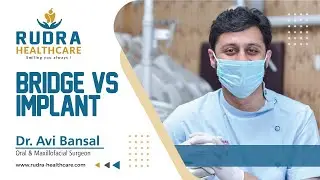 Bridge Vs Implant - Dr. Avi Bansal of Rudra Healthcare, Meerut