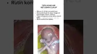 Bisa bahaya lo kalau kekurangan air ketuban, jangan sampai terlambat ya bun☺️