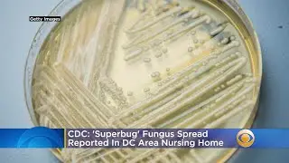'Superbug' Fungus Spread Reported In DC Area Nursing Home, CDC Says