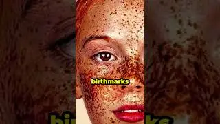 The birthmark theory&hellip;😳 #story #joerogan #storytelling