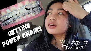 4-month BRACES update (What does the pain REALLY feel like?) Power chains?? #braces #powerchains