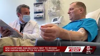 New Hampshire pig kidney transplant recipient now has new human kidney