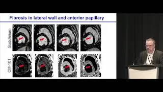 Peter Caravan: Molecular imaging of fibrosis