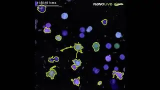 LIVE Cytotoxicity Assay subpopulation segmentation