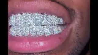Make your icedout grillz vvs bling bling #grillz  #grillz #tooth #icedoutgrillz #diamondgrillz