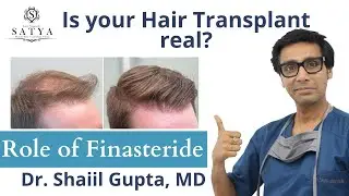 Finasteride Results | Finasteride before and after | Finasteride 1mg |Finax 1mg| Dr.Shaiil | Satya |