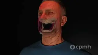 Customlife - Bone Reconstruction