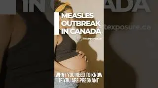 Measles Infection and Pregnancy #measles #pregnancy #MMR #canada