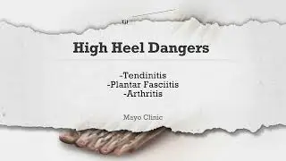 Doctors warn about health impact of wearing high heels