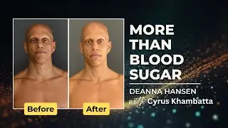 Type 1 Diabetes & Diaphragm Compression | Cyrus’ Incredible Body Transformation