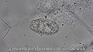 Colurella Rotifer Egg Hatching