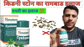 Bas 1 Tablet Ne Stone Nikal Diya! 😳 | Cystone ka Real Review 2025