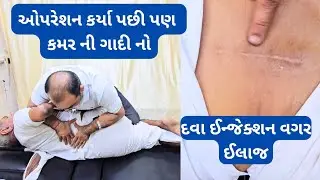 બનાસકાંઠા થી આવતા દાદાને કમરનું ઓપરેશન કરાવ્યા પછી પણ ખાલી ચડતી ચાલવામાં તકલીફ જેનો ઓપરેશન વગર ઈલાજ