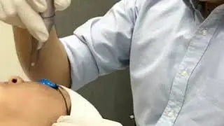 Melasma Laser treatment best in Lahore at My Skin Clinic