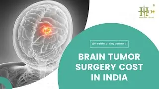 Brain Tumor Surgery Cost In India | HCH - Healthcare In Your Hand | Medical Tourism in India