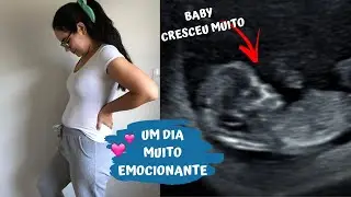 ULTRASSOM MAIS IMPORTANTE E ESPECIAL - 12 SEMANAS  ♥ Greice Brigido