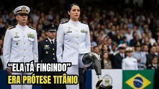 “Tá Fingindo!” — Zoaram Dela… Até Ela Mostrar A Perna Mecânica