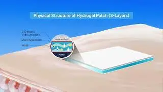 Hydrogel Technology