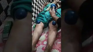 Knee Pain + Lower Back Pain | Patient Got Relief | Natural Ayurvedic Treatment #shortsfeed #shorts