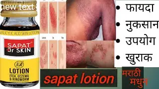 sapat lotion uses in marathi | गचर्कण  खाज खुजलीवर रामबाण उपाय| उपयोग व दुष्परिणाम|#medicine #pharma