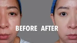 HOW TO CONCEAL DARK CIRCLES | STEP BY STEP