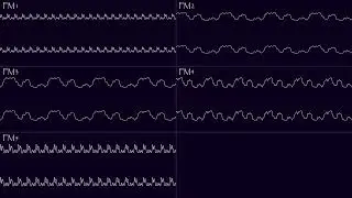 Title Screen (Oscilloscope View) - GameTap, Cup Noodles, and Bitter Tears OST