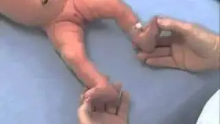 Newborn Examination of the back and feet