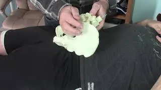 Sacrum Stuck and Lower Pelvic SIJD Sacroiliac Dysfunction Part 1 of 3