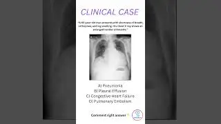 💔 Clinical Case Quiz: Can You Diagnose Heart Failure? | MedQuiz