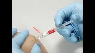 How to use Needle-Trap by Schreiner MediPharm