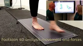 Gait Analysis At Podiatry And Gait Clinic, Middlesbrough and Helmsley.