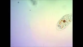 Инфузория класса Oxytricha под микроскопом under microscope