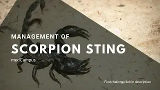 Management of Scorpion Sting | Medcampus | Challenge and Learn