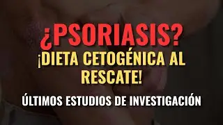 &iquest;PSORIASIS? &iexcl;DIETA CETOGENICA AL RESCATE! &iexcl;&Uacute;LTIMOS ESTUDIOS DE INVESTIGACI&Oacute;N!😮✍️‼️💯