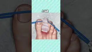 #asmrtreatment #asmrdoctor #usa🇺🇸 #beautyasmr #relaxingasmr
