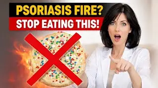 Stop Psoriasis Flares: 7 Foods Killing Your Skin (Over 60s)