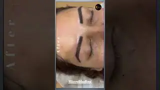 Microblading for Natural-Looking Brows | Asthederm (Aesthetic By Jasmine) Mohali