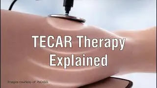 TECAR Explainer Video