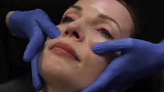 Capillary Refill Test: Identifying Signs of Vascular Occlusion After Filler