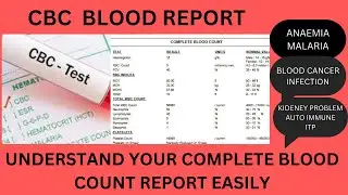 CBC BLOOD TEST CBC REPORT CBC BLOOD REPORT HEMOGRAM COMPLETE BLOOD COUNT HB,TLC,PLT,RBC,WBC,TC,RDW