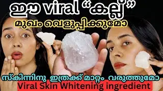 ഇജ്ജാതി!! RESULT😱 മുഖത്തെ ഏത് പ്രശ്നത്തിനും ഇത് മതി Skin whitening, marks, pigmentation,
