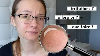 ALLERGIES ? IRRITATIONS ? MES RECOMMANDATIONS !