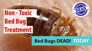 Best Bed Bug Treatments Edmonton - Searching For Bed Bug Treatments In Edmonton? Clients Review