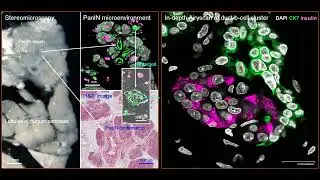 3D/Airyscan super-resolution imaging of human pancreatic duct-b-cell cluster (with music, 1080p HD)