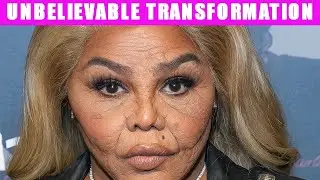 10 failed celebrity plastic surgeries before and after