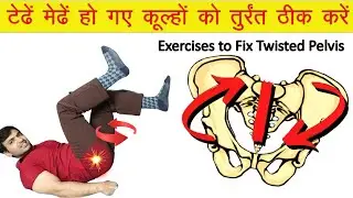 How to fix your own crooked hips | Best Rotated Pelvis Correction Exercises