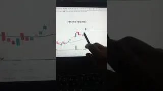 🔥🔥Best stock selection | Stock analysis challenge | #tradelikeshivam #bestswingtradingstrategy